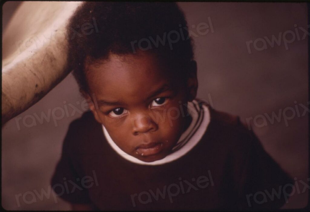 A Black Child On The - a young boy with a collar around his neck