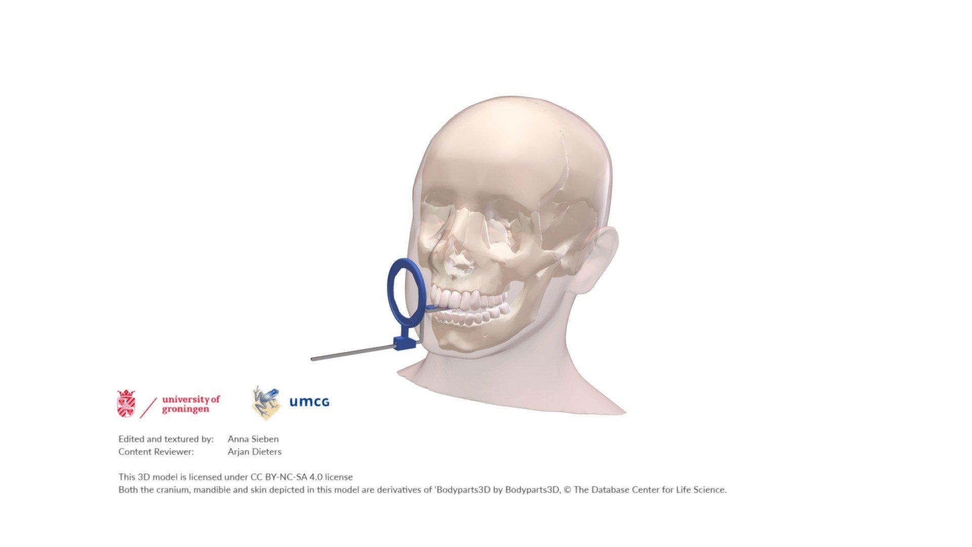Managing Strained Vocal Cords Expert Tips for Relief